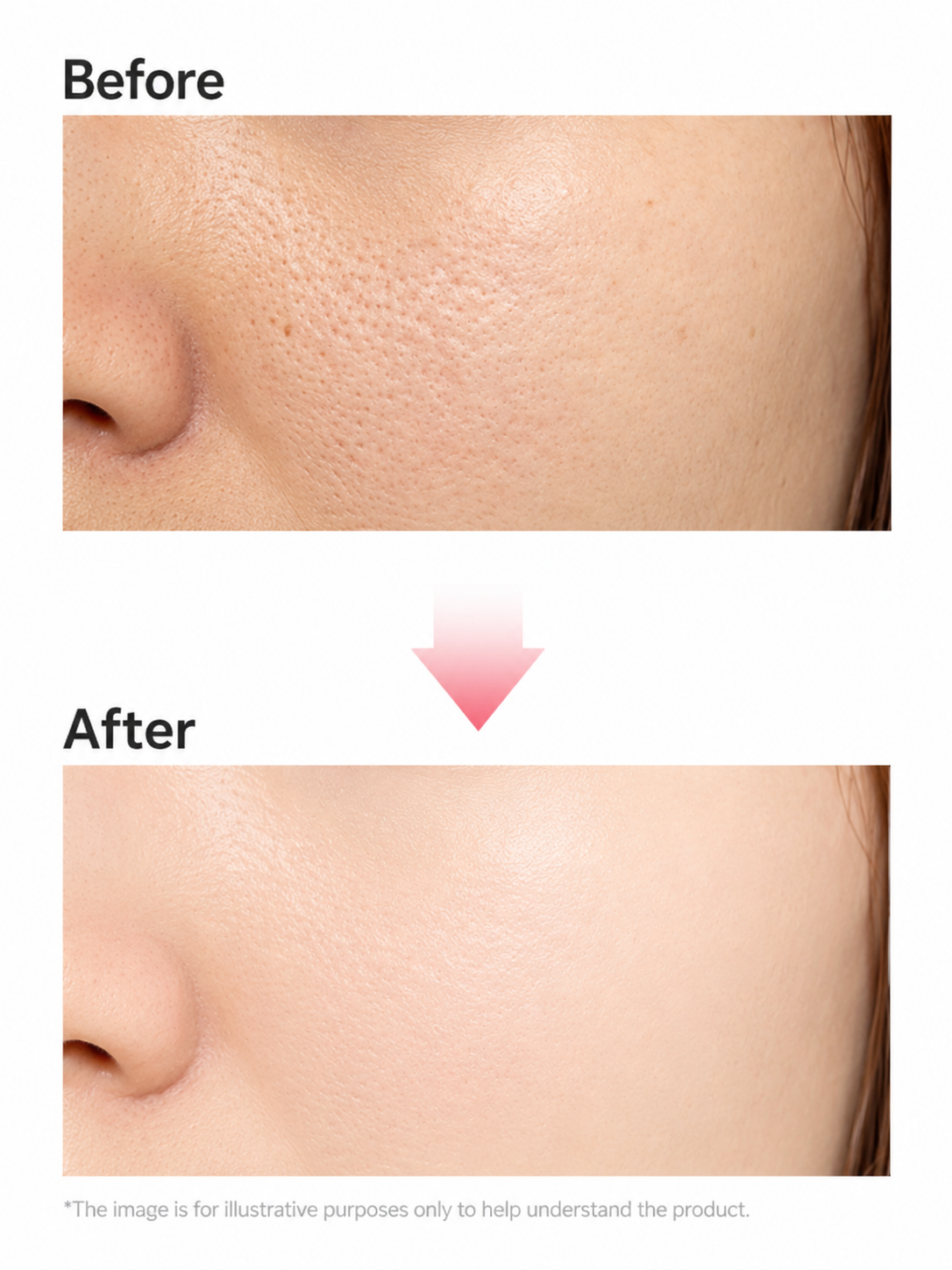 EGF Ampoule