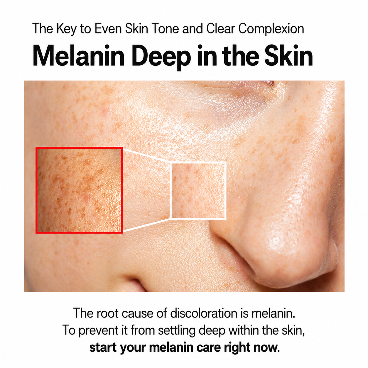 Vitamin Dark Spot Cream